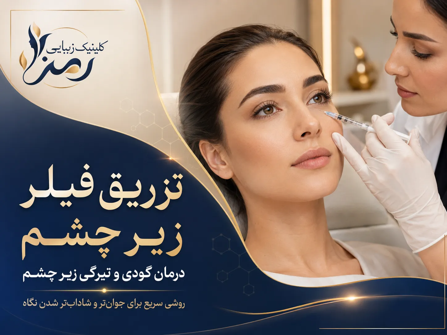 تزریق فیلر زیر چشم