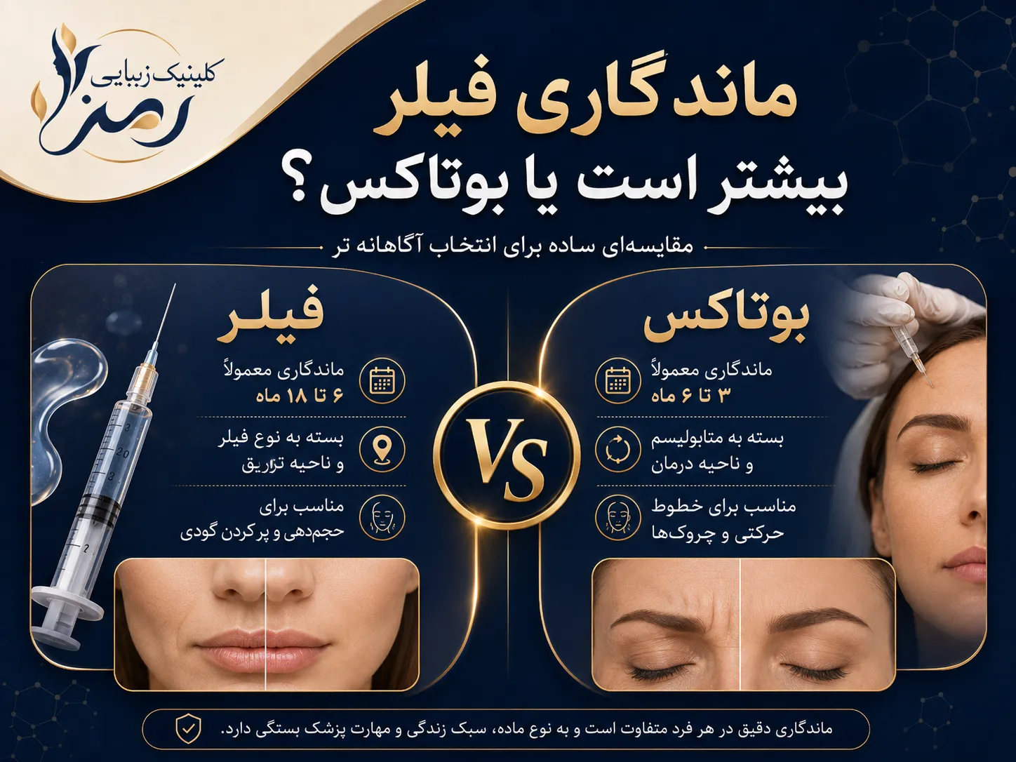 ماندگاری فیلر بیشتر است یا بوتاکس