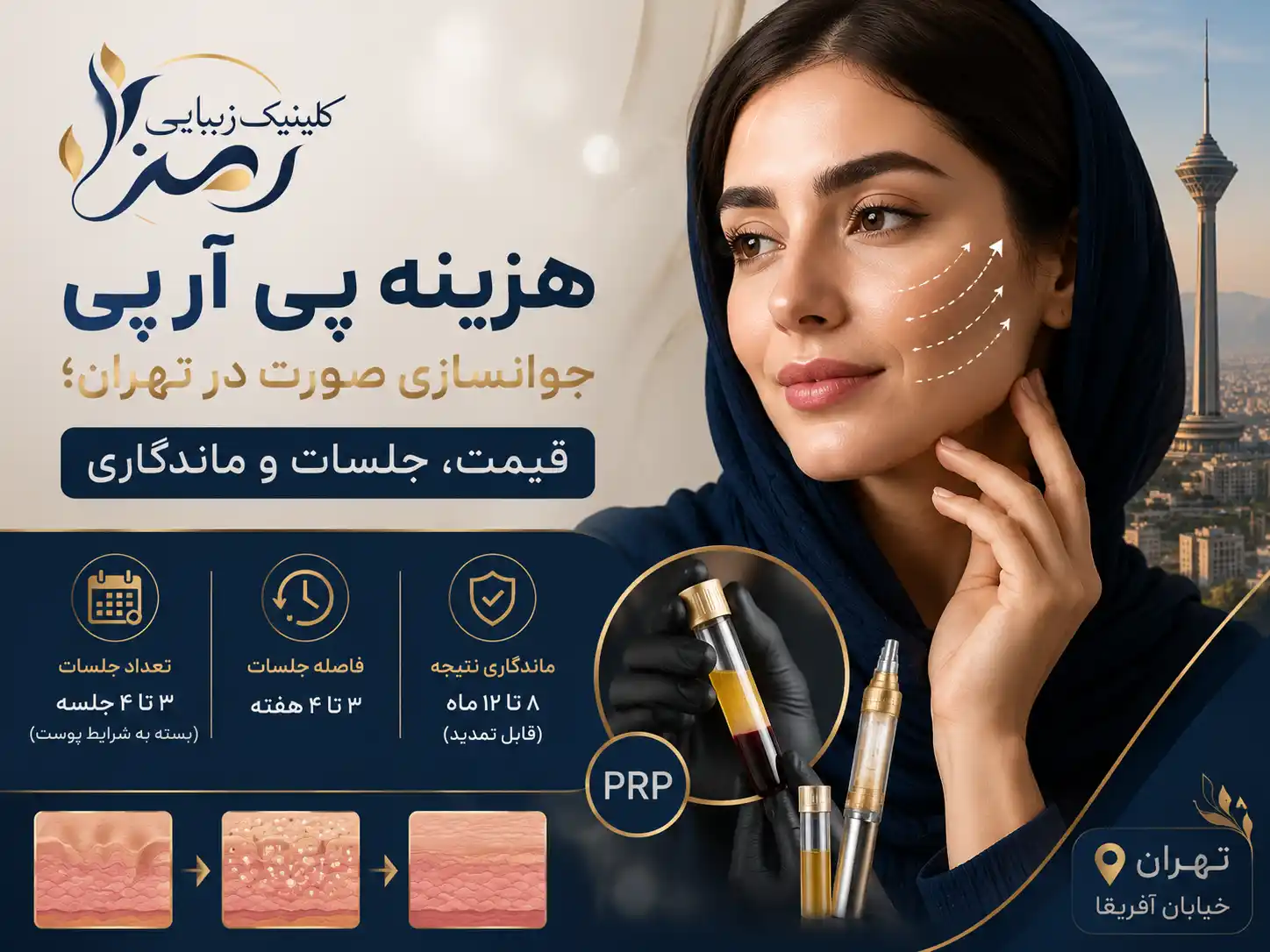 هزینه prp